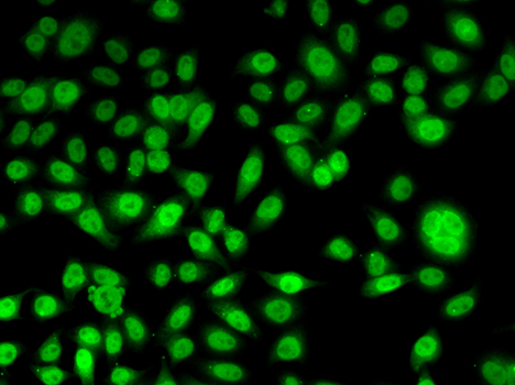 PPL / Periplakin Antibody - Immunofluorescence analysis of U20S cells.