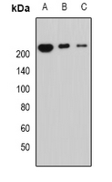PPL / Periplakin Antibody - Western blot analysis of Periplakin expression in MCF7 (A); mouse lung (B); mouse heart (C) whole cell lysates.