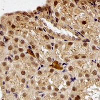PPL / Periplakin Antibody - Immunohistochemical analysis of Periplakin staining in rat kidney formalin fixed paraffin embedded tissue section. The section was pre-treated using heat mediated antigen retrieval with sodium citrate buffer (pH 6.0). The section was then incubated with the antibody at room temperature and detected using an HRP conjugated compact polymer system. DAB was used as the chromogen. The section was then counterstained with hematoxylin and mounted with DPX.