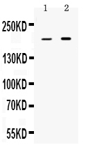 PPL / Periplakin Antibody - Western blot - Anti-Periplakin Picoband Antibody