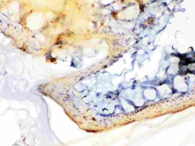 PPL / Periplakin Antibody - Periplakin was detected in paraffin-embedded sections of rat skin tissues using rabbit anti- Periplakin Antigen Affinity purified polyclonal antibody
