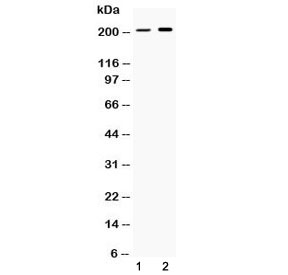 PPL / Periplakin Antibody - Western blot testing of 1) rat stomach and 2) human HeLa lysate with Periplakin antibody at 0.5ug/ml. Predicted molecular weight ~205 kDa.