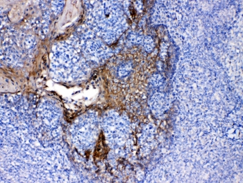 PPL / Periplakin Antibody - IHC testing of FFEP human tonsil tissue with Periplakin antibody at 1ug/ml. Required HIER: steam section in pH6 citrate buffer for 20 min and allow to cool prior to testing.