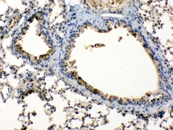 PPL / Periplakin Antibody - IHC testing of FFEP mouse lung tissue with Periplakin antibody at 1ug/ml. Required HIER: steam section in pH6 citrate buffer for 20 min and allow to cool prior to testing.