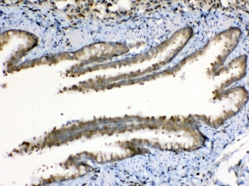 PPL / Periplakin Antibody - IHC testing of FFEP rat lung tissue with Periplakin antibody at 1ug/ml. Required HIER: steam section in pH6 citrate buffer for 20 min and allow to cool prior to testing.