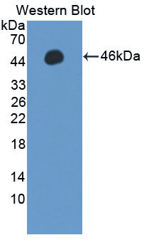 PPM1A / PP2CA Antibody - Western blot of PPM1A / PP2CA antibody.