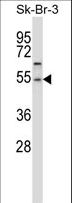 PPM1A / PP2CA Antibody - PPM1A Antibody (pS) western blot of SK-BR-3 cell line lysates (35 ug/lane). The PPM1A antibody detected the PPM1A protein (arrow).