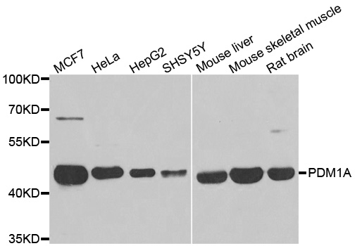 PPM1A / PP2CA Antibody - Western blot analysis of extracts of various cell lines.