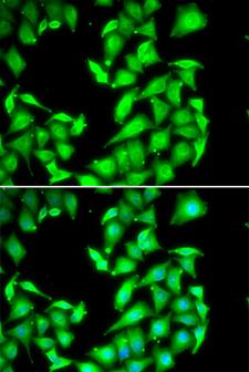 PPM1A / PP2CA Antibody - Immunofluorescence analysis of HeLa cells.