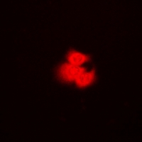 PPM1A / PP2CA Antibody - Immunofluorescent analysis of PP2C-alpha staining in HeLa cells. Formalin-fixed cells were permeabilized with 0.1% Triton X-100 in TBS for 5-10 minutes and blocked with 3% BSA-PBS for 30 minutes at room temperature. Cells were probed with the primary antibody in 3% BSA-PBS and incubated overnight at 4 deg C in a humidified chamber. Cells were washed with PBST and incubated with a DyLight 594-conjugated secondary antibody (red) in PBS at room temperature in the dark.