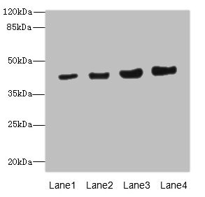 PPM1A / PP2CA Antibody - Western blot All Lanes: PPM1Aantibody at 6.88ug/ml Lane 1 : HepG-2 whole cell lysate Lane 2 : SH-SY5Y whole cell lysate Lane 3 : Mouse liver tissue Lane 4 : Mouse brain tissue Secondary Goat polyclonal to Rabbit IgG at 1/10000 dilution Predicted band size: 43,36,52 kDa Observed band size: 42 kDa