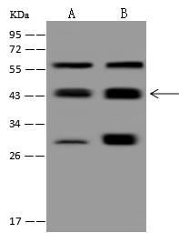 PPM1A / PP2CA Antibody - Anti-PPM1A rabbit polyclonal antibody at 1:2000 dilution. Lane A: HeLa Whole Cell Lysate. Lane B: Raji Whole Cell Lysate. Lysates/proteins at 30 ug per lane. Secondary: Goat Anti-Rabbit IgG (H+L)/HRP at 1/10000 dilution. Developed using the ECL technique. Performed under reducing conditions. Predicted band size: 42 kDa. Observed band size: 44 kDa. (We are unsure as to the identity of these extra bands.)