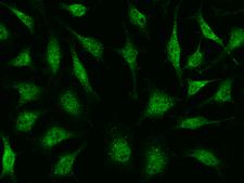 PPM1A / PP2CA Antibody - Immunofluorescence staining of PPM1A in Hela cells. Cells were fixed with 4% PFA, permeabilzed with 0.1% Triton X-100 in PBS, blocked with 10% serum, and incubated with rabbit anti-Human PPM1A polyclonal antibody (dilution ratio 1:1000) at 4°C overnight. Then cells were stained with the Alexa Fluor 488-conjugated Goat Anti-rabbit IgG secondary antibody (green). Positive staining was localized to cytoplasm and nucleus.
