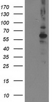 PPM1B Antibody - HEK293T cells were transfected with the pCMV6-ENTRY control (Left lane) or pCMV6-ENTRY PPM1B (Right lane) cDNA for 48 hrs and lysed. Equivalent amounts of cell lysates (5 ug per lane) were separated by SDS-PAGE and immunoblotted with anti-PPM1B.