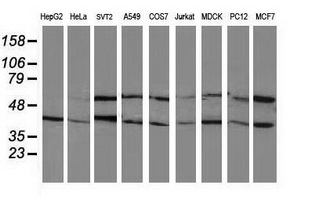 PPM1B Antibody - Western blot of extracts (35 ug) from 9 different cell lines by using anti-PPM1B monoclonal antibody.
