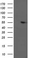 PPM1B Antibody - HEK293T cells were transfected with the pCMV6-ENTRY control (Left lane) or pCMV6-ENTRY PPM1B (Right lane) cDNA for 48 hrs and lysed. Equivalent amounts of cell lysates (5 ug per lane) were separated by SDS-PAGE and immunoblotted with anti-PPM1B.