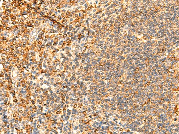 PPM1B Antibody - Immunohistochemistry of paraffin-embedded Human tonsil tissue  using PPM1B Polyclonal Antibody at dilution of 1:50(×200)