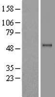 PPM1B Protein - Western validation with an anti-DDK antibody * L: Control HEK293 lysate R: Over-expression lysate