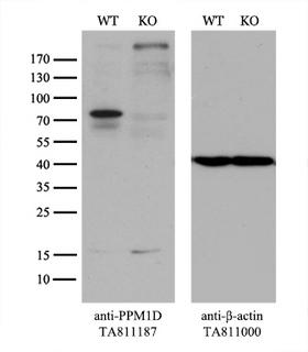 PPM1D / WIP1 Antibody - Equivalent amounts of cell lysates  and PPM1D-Knockout 293T cells  were separated by SDS-PAGE and immunoblotted with anti-PPM1D monoclonal antibody(1:200). Then the blotted membrane was stripped and reprobed with anti-b-actin antibody  as a loading control.