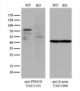PPM1D / WIP1 Antibody - Equivalent amounts of cell lysates  and PPM1D-Knockout 293T cells  were separated by SDS-PAGE and immunoblotted with anti-PPM1D monoclonal antibody(1:500). Then the blotted membrane was stripped and reprobed with anti-b-actin antibody  as a loading control.