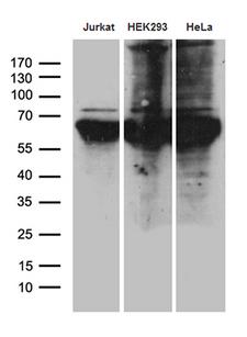 PPM1D / WIP1 Antibody - Western blot analysis of extracts. (35ug) from 3 different cell lines by using anti-PPM1D monoclonal antibody. (1:500)