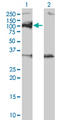 PPM1D / WIP1 Antibody - Western Blot analysis of PPM1D expression in transfected 293T cell line by PPM1D monoclonal antibody (M01), clone 4D1.Lane 1: PPM1D transfected lysate(66.7 KDa).Lane 2: Non-transfected lysate.