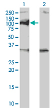 PPM1D / WIP1 Antibody - Western Blot analysis of PPM1D expression in transfected 293T cell line by PPM1D monoclonal antibody (M01), clone 4D1.Lane 1: PPM1D transfected lysate(66.7 KDa).Lane 2: Non-transfected lysate.
