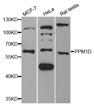 PPM1D / WIP1 Antibody - Western blot analysis of extracts of various cell lines.