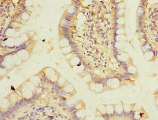 PPM1D / WIP1 Antibody - Immunohistochemistry of paraffin-embedded human small intestine at dilution 1:100
