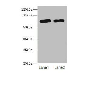 PPM1D / WIP1 Antibody - Western blot All Lanes: PPM1Dantibody at 2.36ug/ml Lane 1 : Rat gonadal tissue Lane 2 : U87 whole cell lysate Secondary Goat polyclonal to Rabbit IgG at 1/10000 dilution Predicted band size: 67,48 kDa Observed band size: 67 kDa