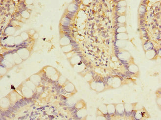 PPM1D / WIP1 Antibody - Immunohistochemistry of paraffin-embedded human small intestine at dilution 1:100