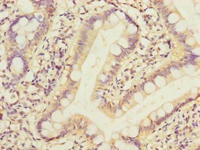 PPM1D / WIP1 Antibody - Immunohistochemistry of paraffin-embedded human small intestine tissue using PPM1D Antibody at dilution of 1:100