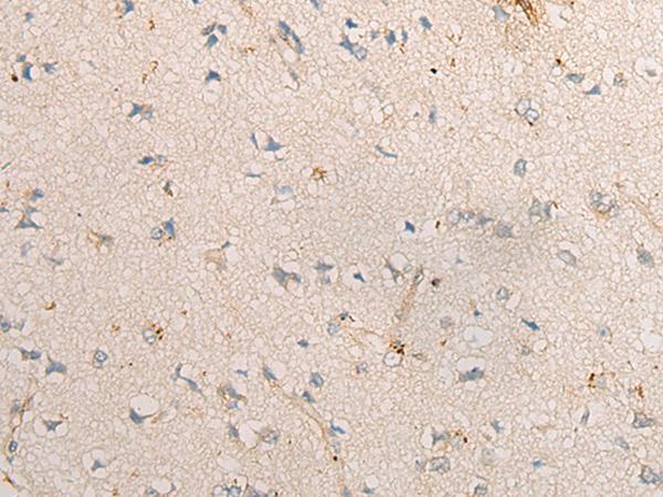 PPM1D / WIP1 Antibody - Immunohistochemistry of paraffin-embedded Human brain tissue  using PPM1D Polyclonal Antibody at dilution of 1:60(×200)