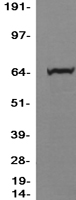 PPM1D / WIP1 Protein - Western validation with an anti-DDK antibody * L: Control HEK293 lysate R: Over-expression lysate