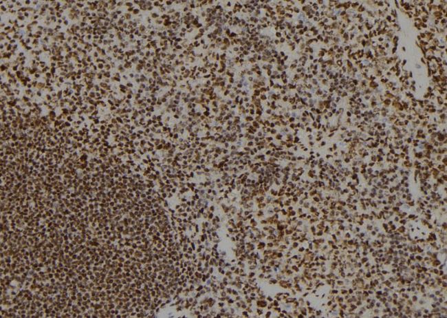 PPM1E Antibody - 1:100 staining mouse spleen tissue by IHC-P. The sample was formaldehyde fixed and a heat mediated antigen retrieval step in citrate buffer was performed. The sample was then blocked and incubated with the antibody for 1.5 hours at 22°C. An HRP conjugated goat anti-rabbit antibody was used as the secondary.