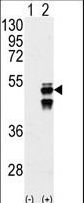 PPM1F Antibody - Western blot of PPM1F (arrow) using PPM1F Antibody. 293 cell lysates (2 ug/lane) either nontransfected (Lane 1) or transiently transfected with the PPM1F gene (Lane 2) (Origene Technologies).