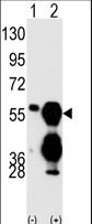 PPM1F Antibody - Western blot of PPM1F (arrow) using PPM1F Antibody. 293 cell lysates (2 ug/lane) either nontransfected (Lane 1) or transiently transfected with the PPM1F gene (Lane 2) (Origene Technologies).