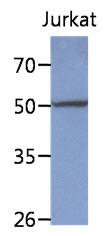 PPM1F Antibody - Western Blot: The lysate of Jurkat (40 ug) were resolved by SDS-PAGE, transferred to PVDF membrane and probed with anti-human PPM1F antibody (1:1000). Proteins were visualized using a goat anti-mouse secondary antibody conjugated to HRP and an ECL detection system.