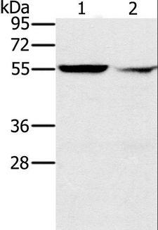 PPM1F Antibody - Western blot analysis of K562 cell and human fetal liver tissue, using PPM1F Polyclonal Antibody at dilution of 1:200.