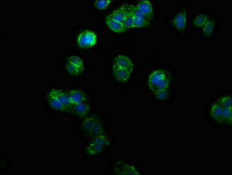 PPM1F Antibody - Immunofluorescence staining of HepG2 cells at a dilution of 1:133, counter-stained with DAPI. The cells were fixed in 4% formaldehyde, permeabilized using 0.2% Triton X-100 and blocked in 10% normal Goat Serum. The cells were then incubated with the antibody overnight at 4°C.The secondary antibody was Alexa Fluor 488-congugated AffiniPure Goat Anti-Rabbit IgG (H+L) .