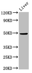 PPM1F Antibody - Positive Western Blot detected in Mouse liver tissue. All lanes: PPM1F antibody at 3 µg/ml Secondary Goat polyclonal to rabbit IgG at 1/50000 dilution. Predicted band size: 50, 39 KDa. Observed band size: 50 KDa