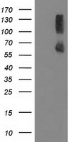 PPM1G Antibody - HEK293T cells were transfected with the pCMV6-ENTRY control (Left lane) or pCMV6-ENTRY PPM1G (Right lane) cDNA for 48 hrs and lysed. Equivalent amounts of cell lysates (5 ug per lane) were separated by SDS-PAGE and immunoblotted with anti-PPM1G.