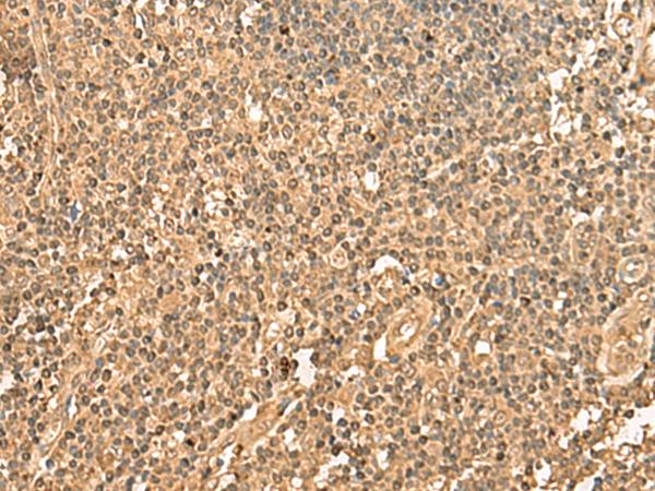 PPM1G Antibody - Immunohistochemistry of paraffin-embedded Human tonsil tissue  using PPM1G Polyclonal Antibody at dilution of 1:40(×200)