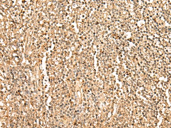 PPM1G Antibody - Immunohistochemistry of paraffin-embedded Human tonsil tissue  using PPM1G Polyclonal Antibody at dilution of 1:35(×200)