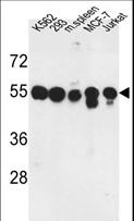 PPM1H Antibody - Western blot of PPM1H Antibody in K562, 293, MCF-7, Jurkat cell line and mouse spleen tissue lysates (35 ug/lane). PPM1H (arrow) was detected using the purified antibody.