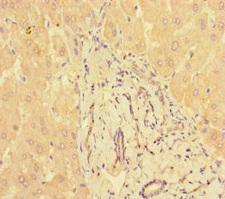 PPM1H Antibody - Immunohistochemistry of paraffin-embedded human liver tissue at dilution of 1:100