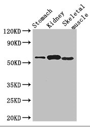PPM1H Antibody - Western Blot Positive WB detected in:Mouse stomach tissue,Mouse kidney tissue,Mouse skeletal muscle tissue All Lanes: PPM1H antibody at 3.2ug/ml Secondary Goat polyclonal to rabbit IgG at 1/50000 dilution Predicted band size: 57 kDa Observed band size: 57 kDa