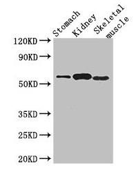 PPM1H Antibody - Western Blot Positive WB detected in: Mouse stomach tissue, Mouse kidney tissue, Mouse skeletal muscle tissue All lanes: PPM1H antibody at 3.2µg/ml Secondary Goat polyclonal to rabbit IgG at 1/50000 dilution Predicted band size: 57 kDa Observed band size: 57 kDa