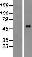 PPM1H Protein - Western validation with an anti-DDK antibody * L: Control HEK293 lysate R: Over-expression lysate