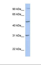 PPM1J Antibody - 721_B cell lysate. Antibody concentration: 1.0 ug/ml. Gel concentration: 12%.  This image was taken for the unconjugated form of this product. Other forms have not been tested.